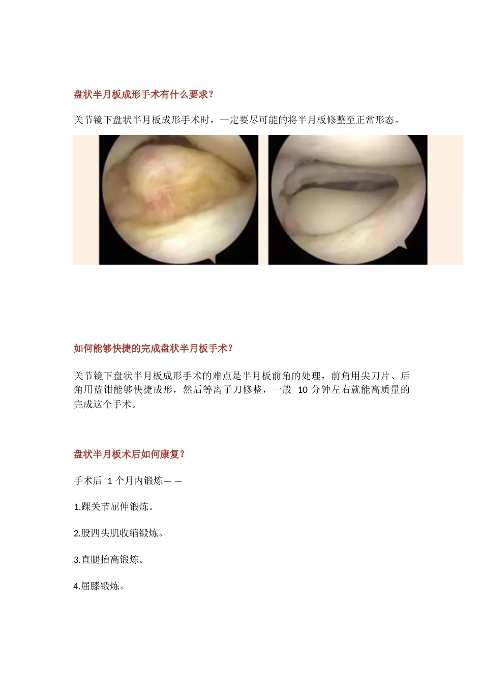 盘状半月板2_第10页