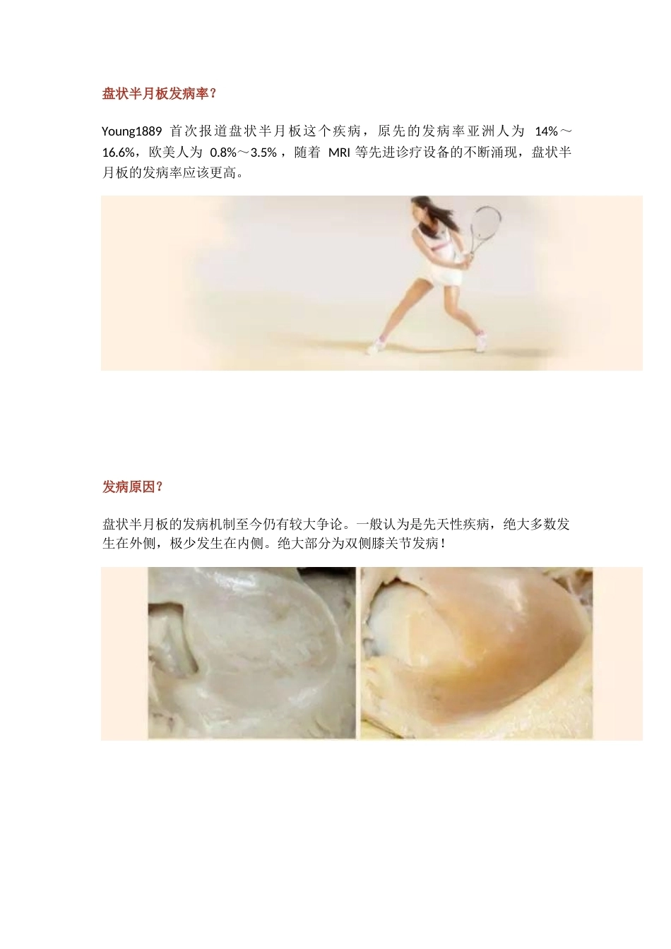 盘状半月板2_第2页