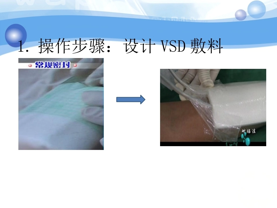 负压吸引在骨科中的应用(2)_第9页