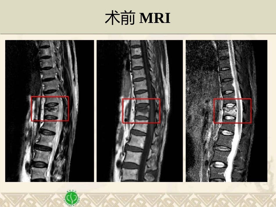 精准椎体成形术2_第7页
