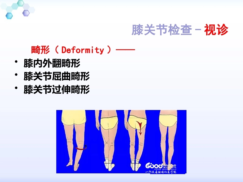 膝关节体格检查2_第12页