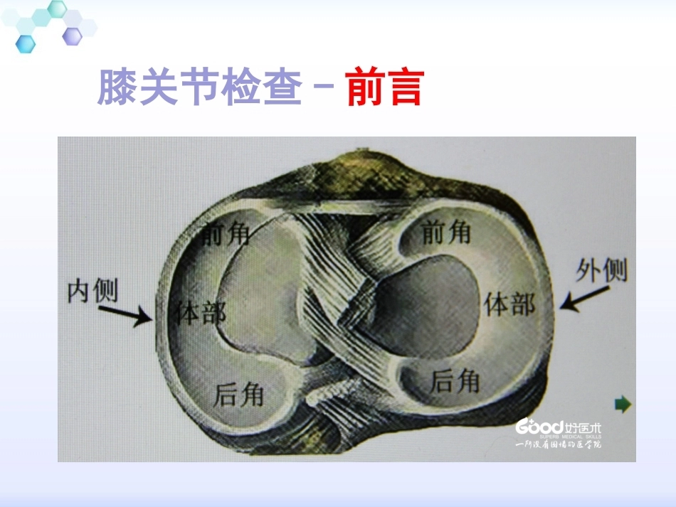 膝关节体格检查2_第4页