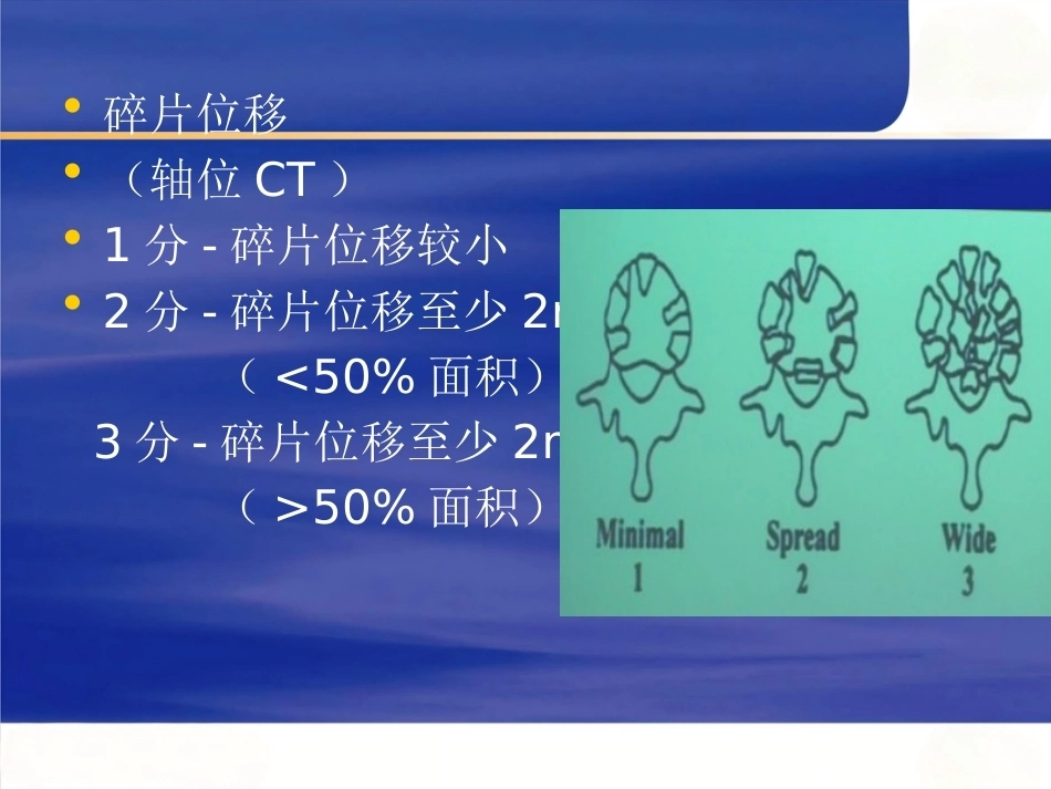 胸腰椎骨折选择治疗2_第7页