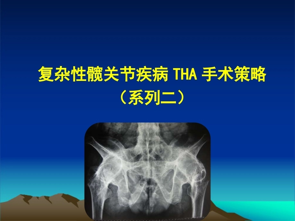 复杂性髋关节THA系列二 ( 2)_第1页