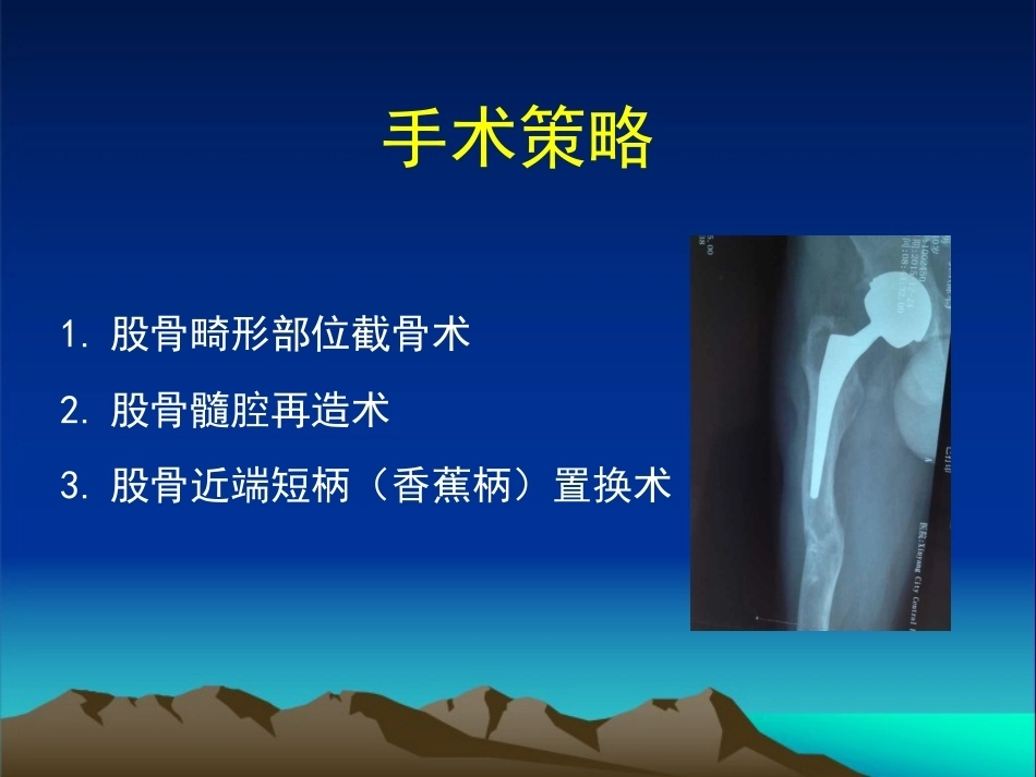 复杂性髋关节THA系列二 ( 2)_第15页