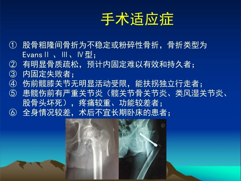 复杂性髋关节THA系列二 ( 2)_第4页