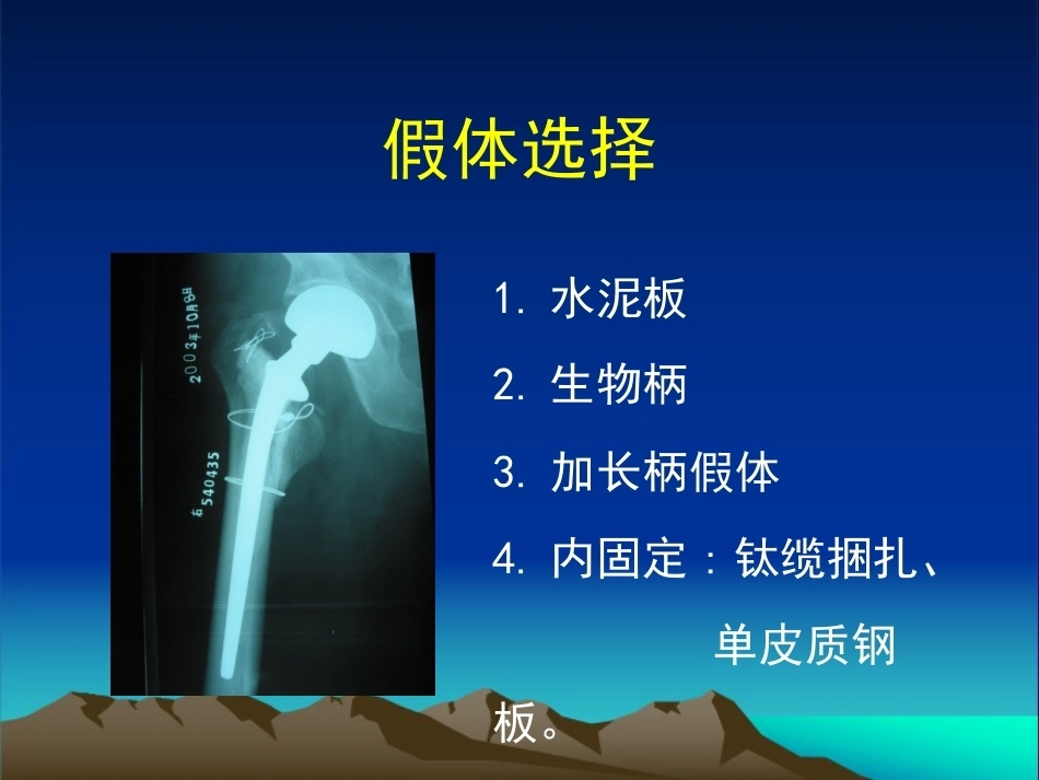 复杂性髋关节THA系列二 ( 2)_第5页