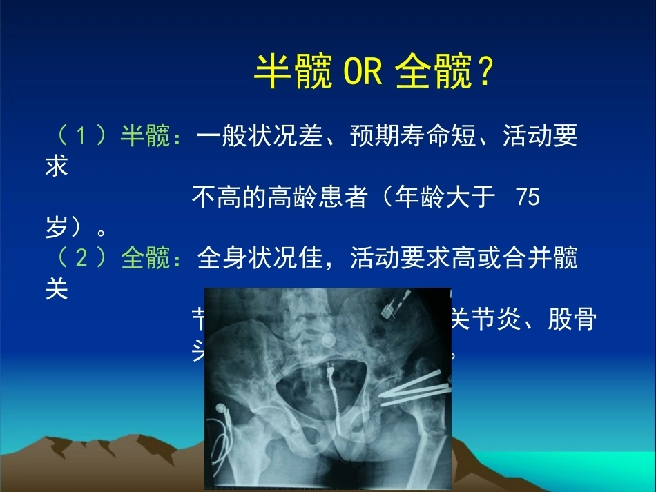 复杂性髋关节THA系列二 ( 2)_第7页