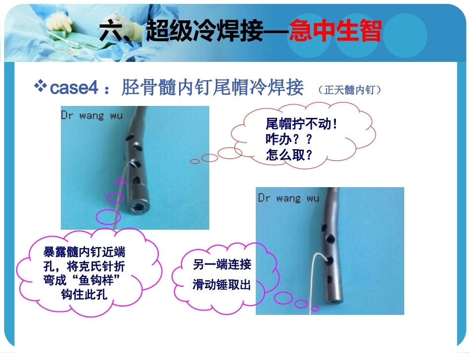 困难内固定装置取出技巧2_第13页