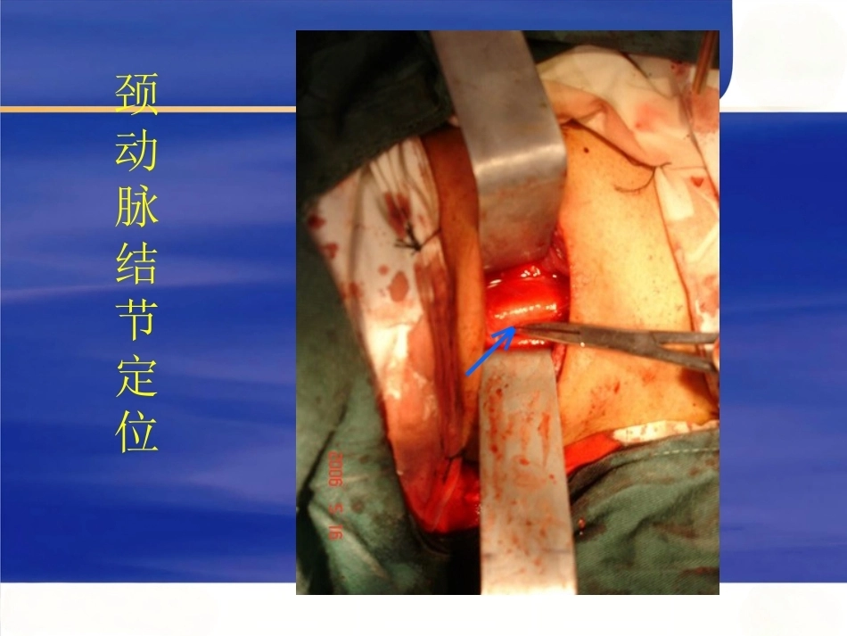 颈椎前路手术操作技术2_第10页