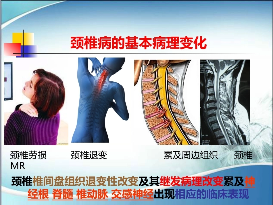 颈椎病的诊断与治疗(2)_第11页