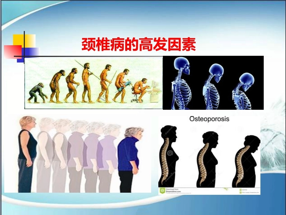颈椎病的诊断与治疗(2)_第12页