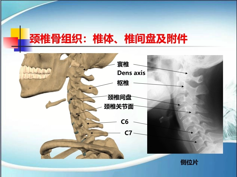 颈椎病的诊断与治疗(2)_第6页