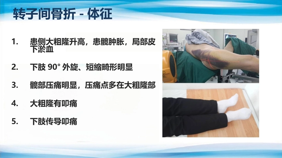 转子间骨折(2)_第12页
