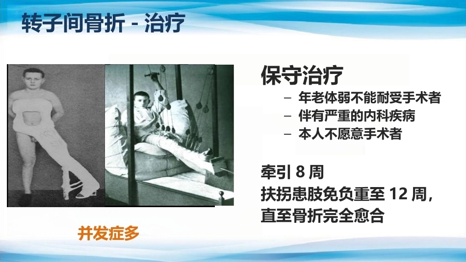 转子间骨折(2)_第14页