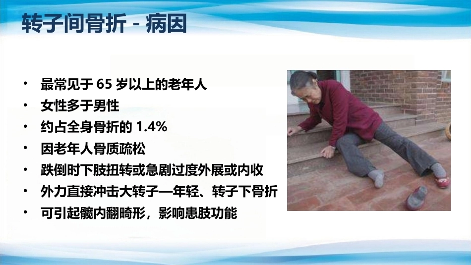 转子间骨折(2)_第4页