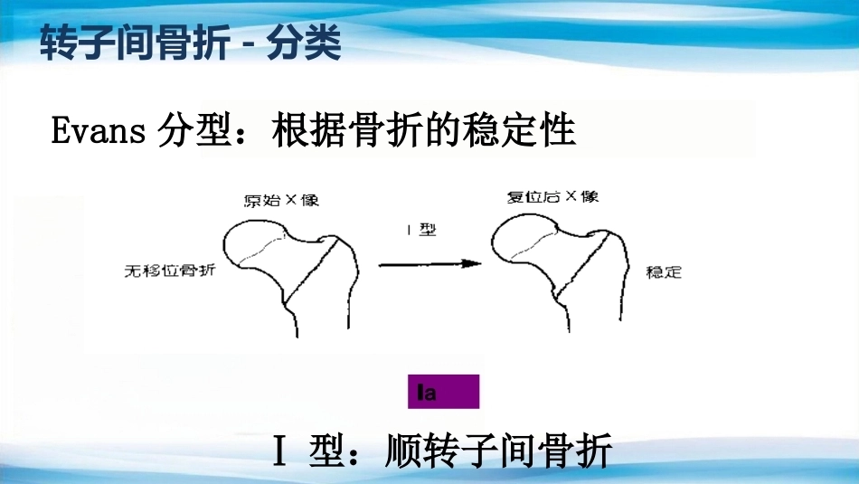 转子间骨折(2)_第5页