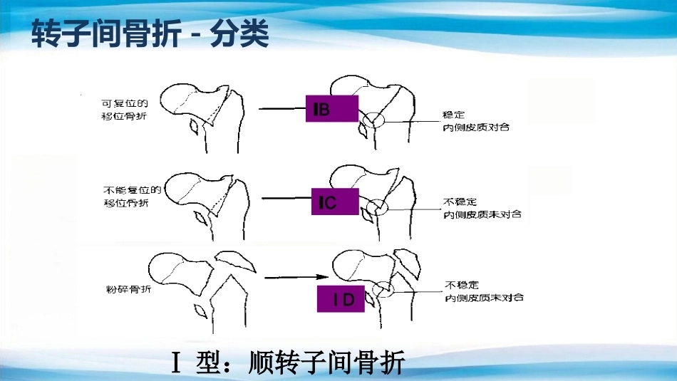 转子间骨折(2)_第6页