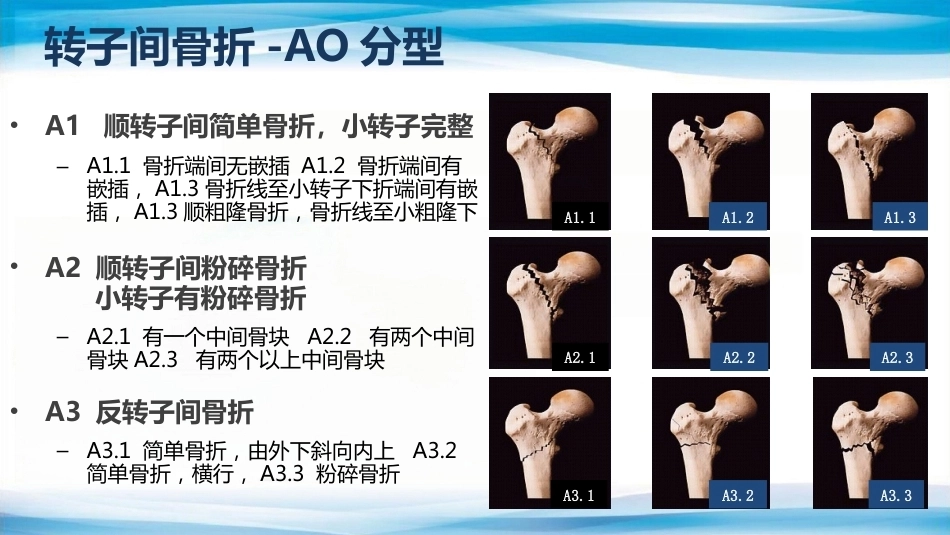 转子间骨折(2)_第8页