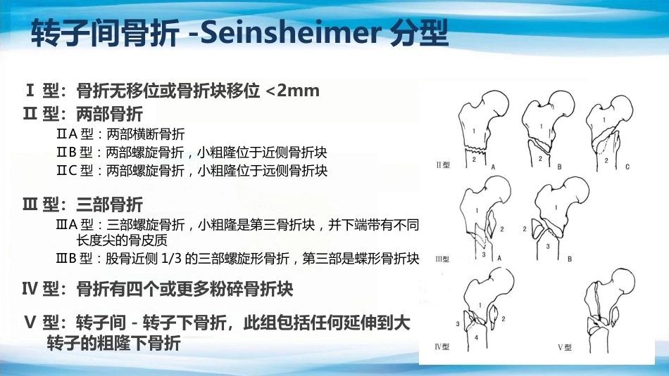 转子间骨折(2)_第9页