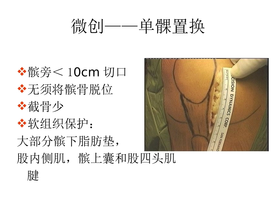 膝关节单髁置换（2）_第6页