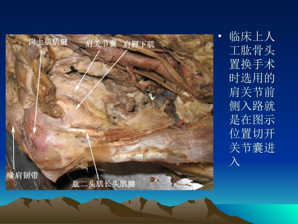 骨科解剖及手术切口入路(2)_第10页