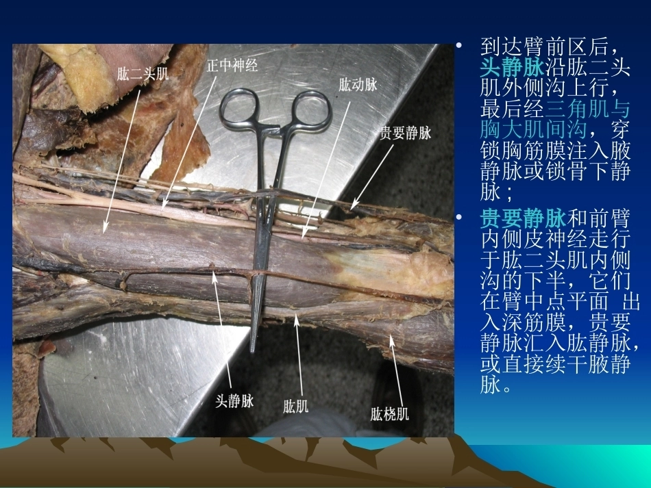 骨科解剖及手术切口入路(2)_第12页