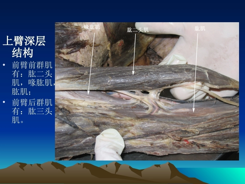 骨科解剖及手术切口入路(2)_第13页