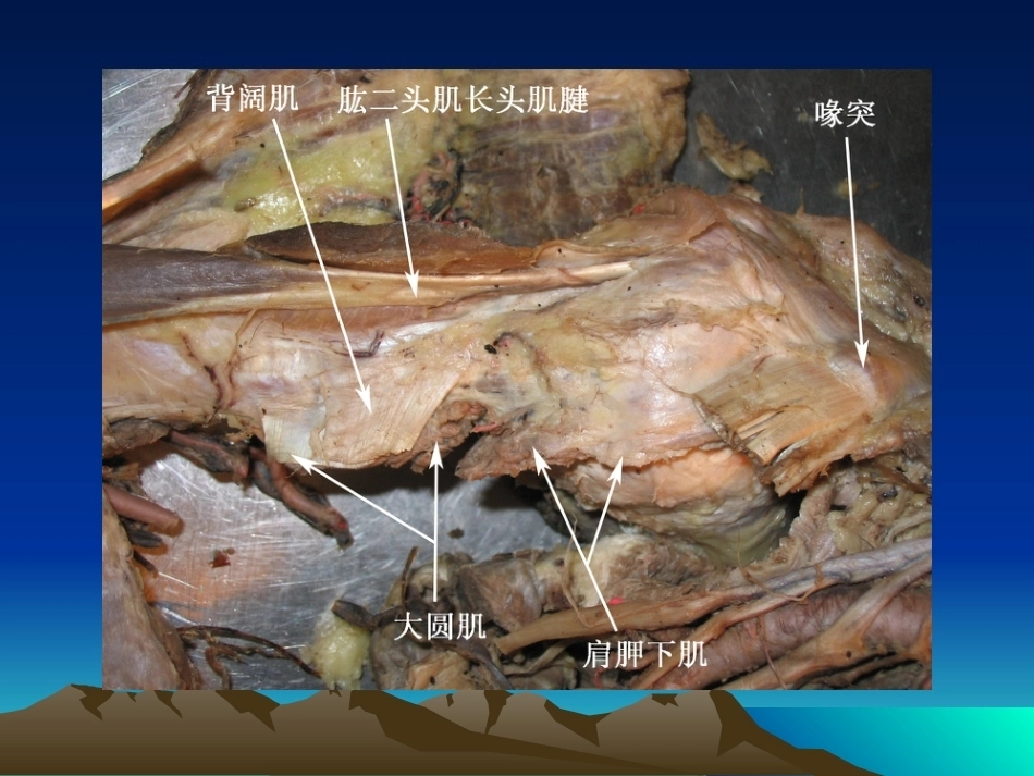 骨科解剖及手术切口入路(2)_第6页