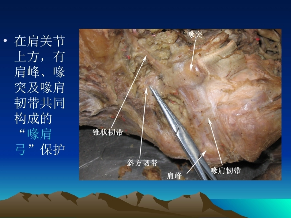 骨科解剖及手术切口入路(2)_第8页