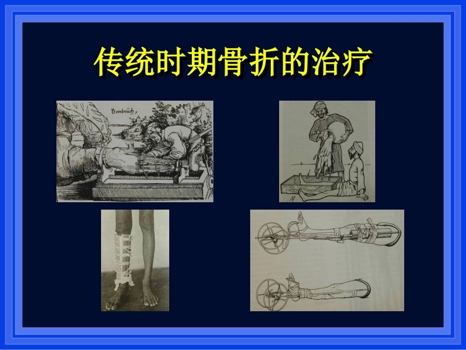 2.AO与BO理念_第3页