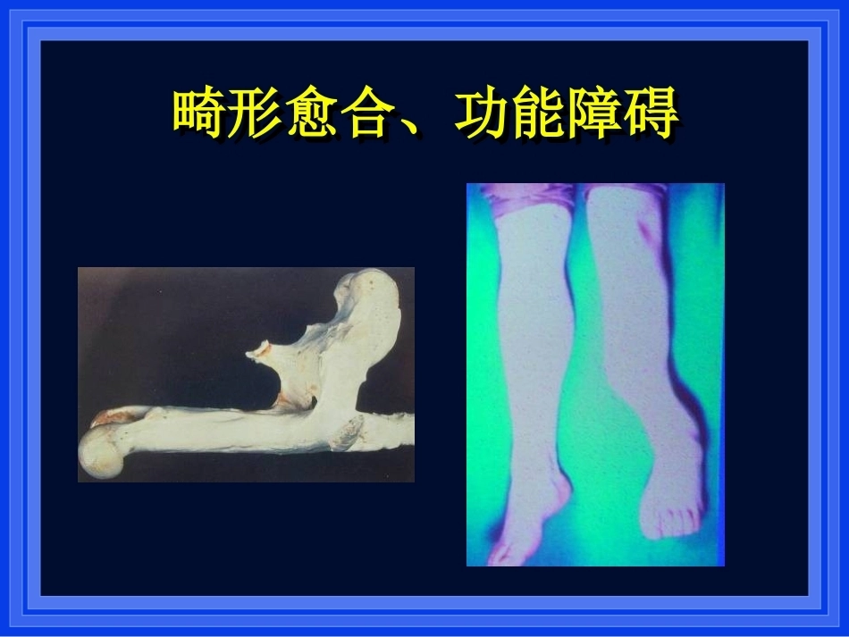 2.AO与BO理念_第4页