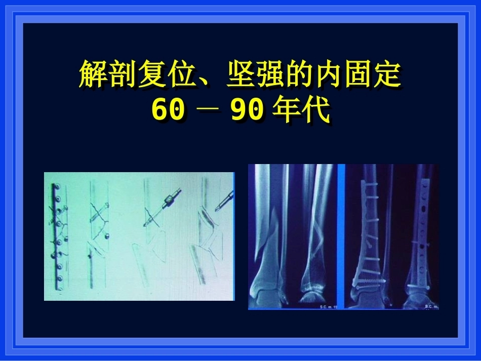 2.AO与BO理念_第5页