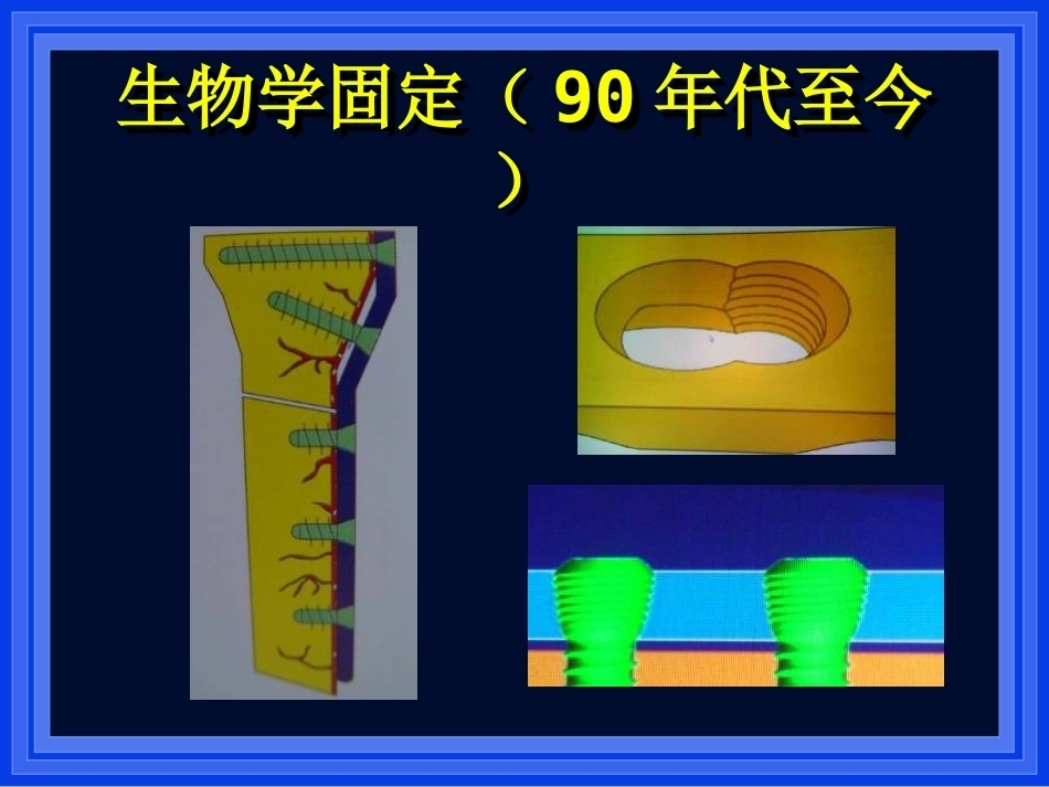2.AO与BO理念_第6页