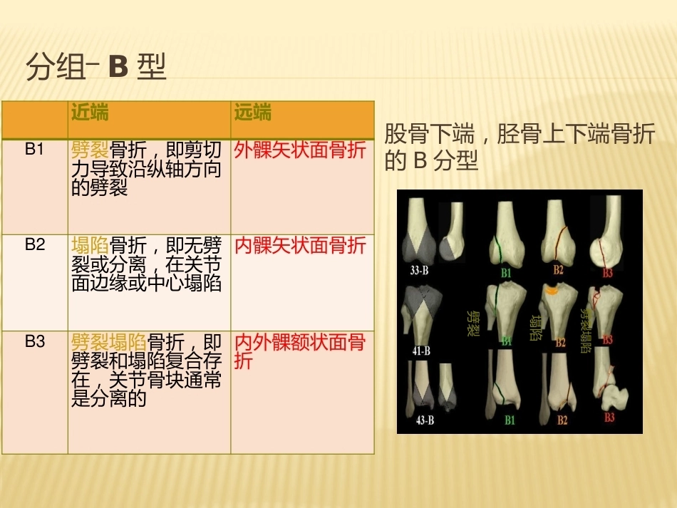2.骨折AO分型_第14页