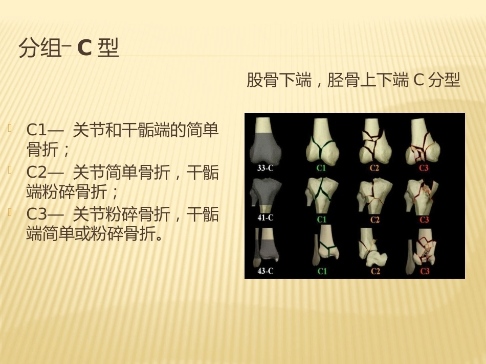 2.骨折AO分型_第15页