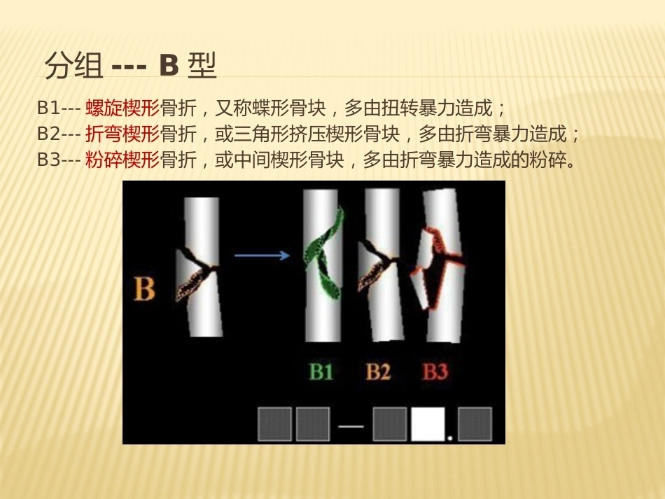 2.骨折AO分型_第8页