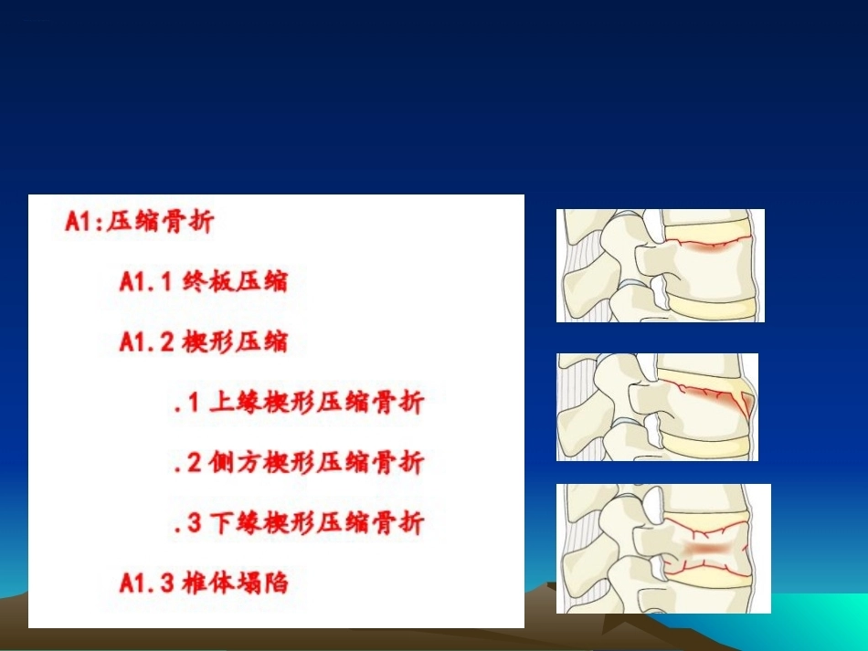 脊柱骨折常用分型及治疗原则2_第14页
