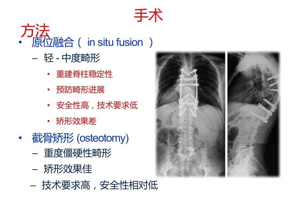 陈旧性结核后凸的手术治疗(2)_第11页
