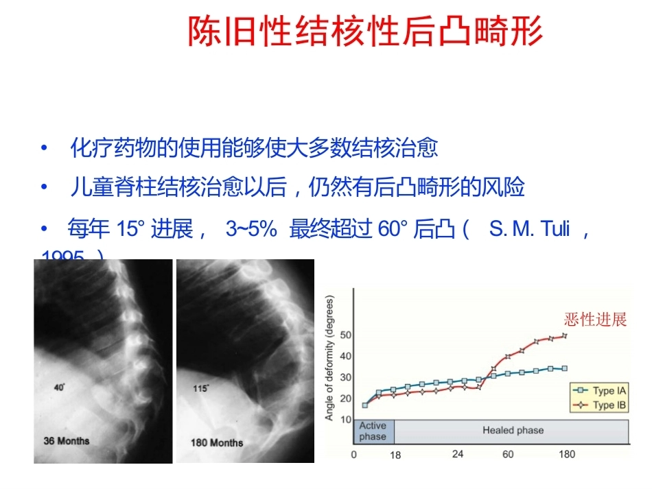 陈旧性结核后凸的手术治疗(2)_第2页