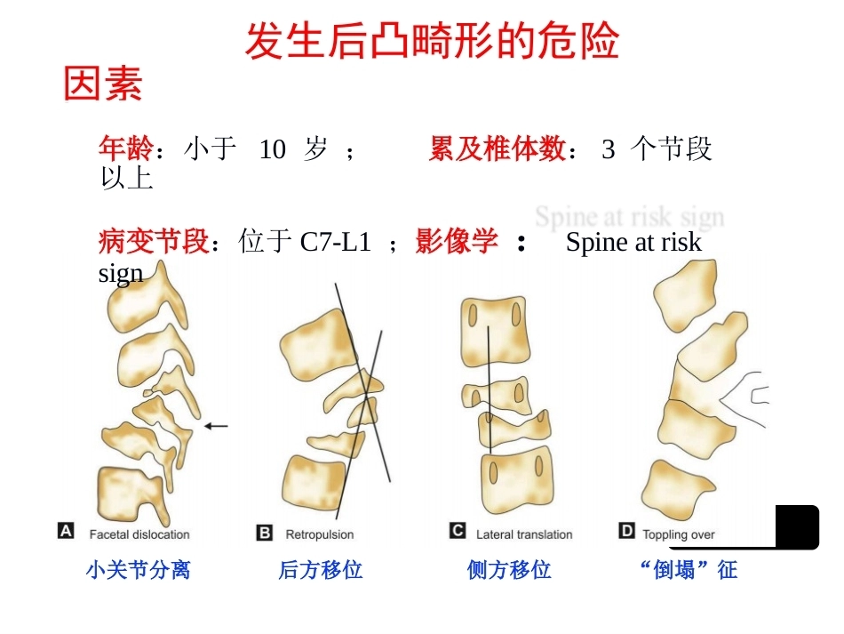 陈旧性结核后凸的手术治疗(2)_第3页