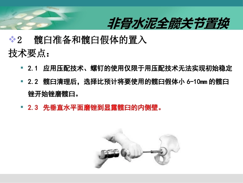 人工髋关节置换术2_第13页