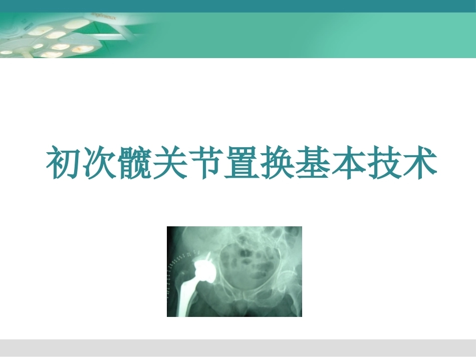人工髋关节置换术2_第9页