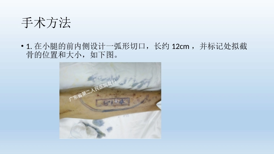 浅说胫骨横向骨搬移技术(2)_第10页