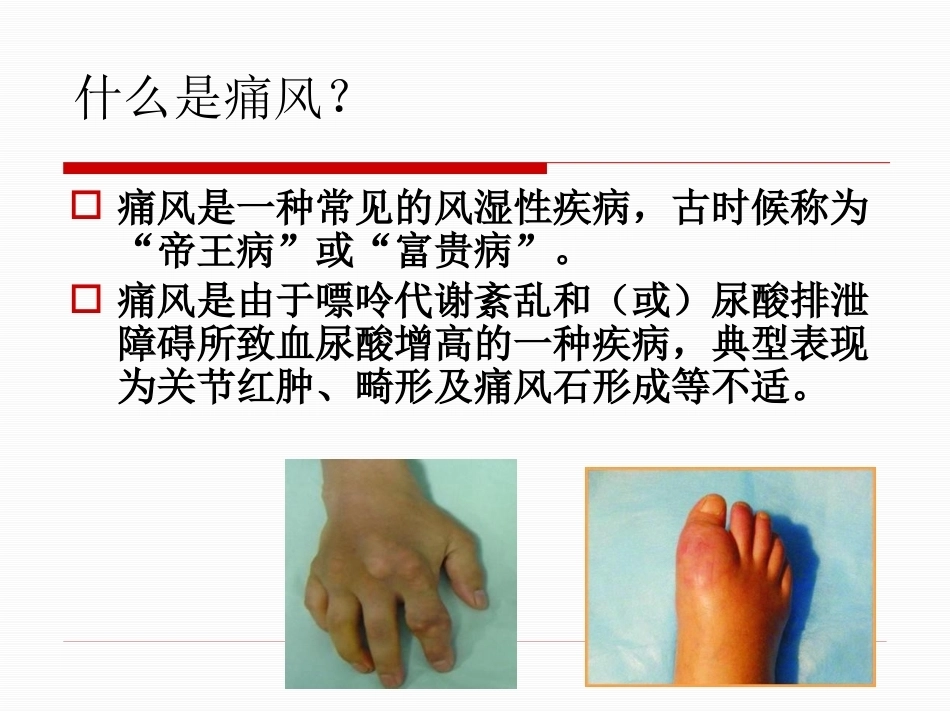 痛风性关节炎的规范化治疗2_第2页