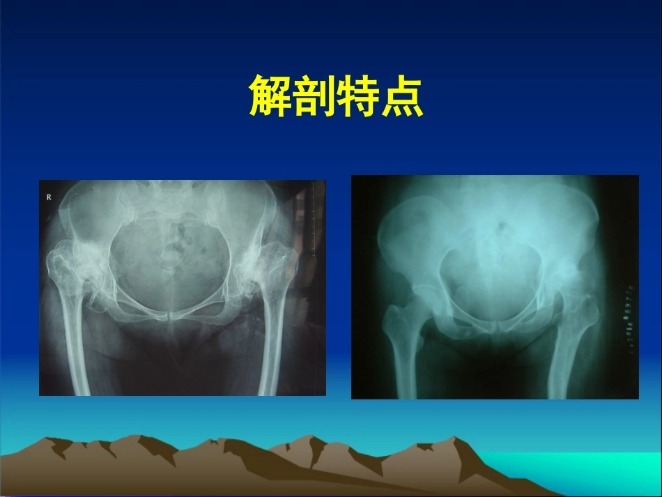 复杂性髋关节THA系列一（3）_第15页
