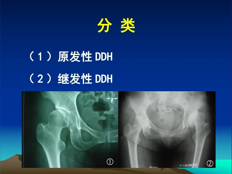 复杂性髋关节THA系列一（3）_第6页