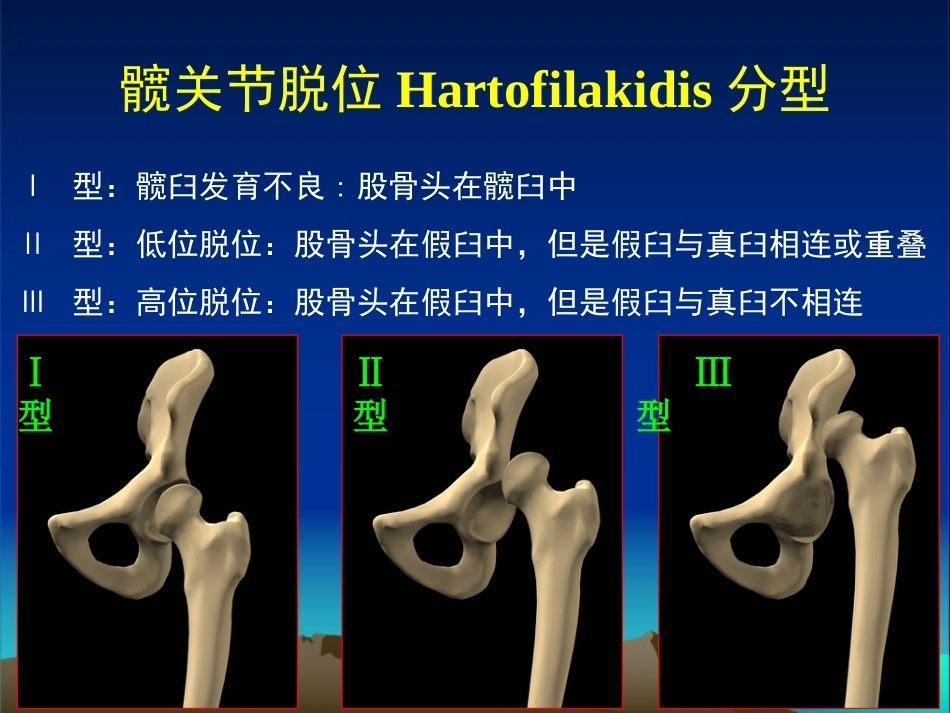 复杂性髋关节THA系列一（3）_第7页