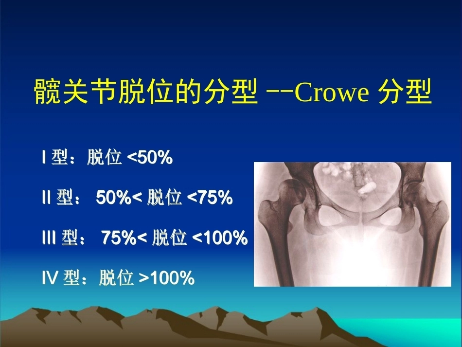 复杂性髋关节THA系列一（3）_第9页