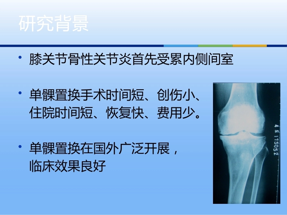 膝关节单髁置换（3）_第2页
